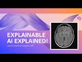 Explainable AI explained! | #6 Layerwise Relevance Propagation with MRI data