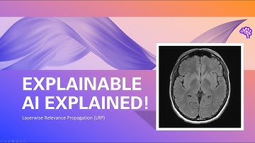 Explainable AI explained! | #6 Layerwise Relevance Propagation with MRI data