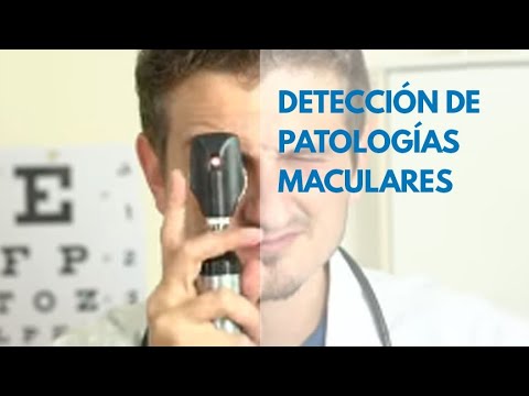 👨‍🎓 Detección de