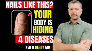 Neurologist Warns If Your NAILS Look Like THIS After 60, Your Body May be Hiding 4 Diseases Mandell