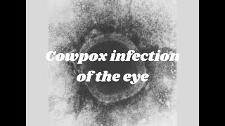 Cowpox of the eye- A rare case