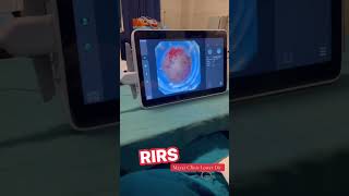 #rirs #rirskidneystone #urologist #foryou #pakistan #shorts #fylp