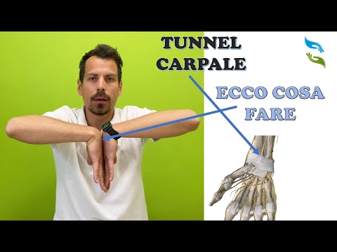 Video: Come Usare il Kinesio Tape per la Sindrome del Tunnel Carpale: 12 Passaggi