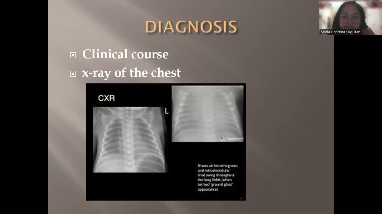 NCM 109 LEC SEMIS LESSON 1-3