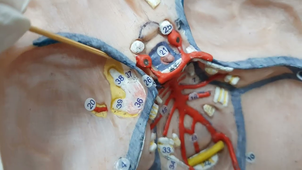 N. trigeminus (CN V) Anatomisi ve Kliniği (Devam videosu) (Nervi craniales-Kranial Sinirler)