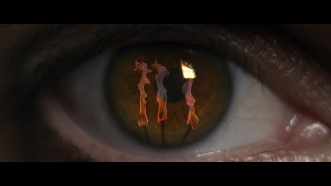 “Ojos Rojos” - Kchiporros (2014)