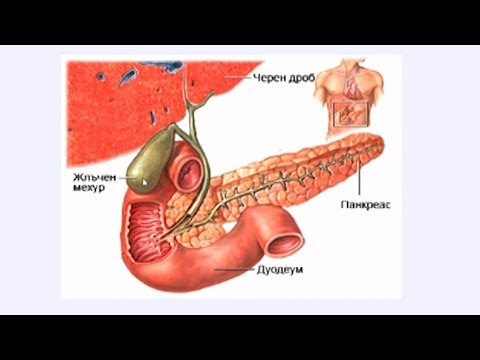 Video: Kanceri I Pankreasit (Adenokarcinoma) Tek Qentë