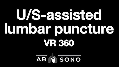 U/S-guided lumbar puncture approach