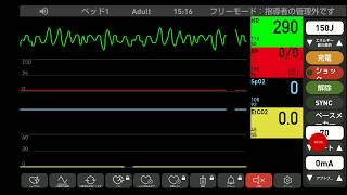 心電図モニター シュミレーション　心室細動V FIB→心拍再開
