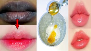 Get soft pink lips in just 5 minutes at home | Permanent juicy pink lips screenshot 2