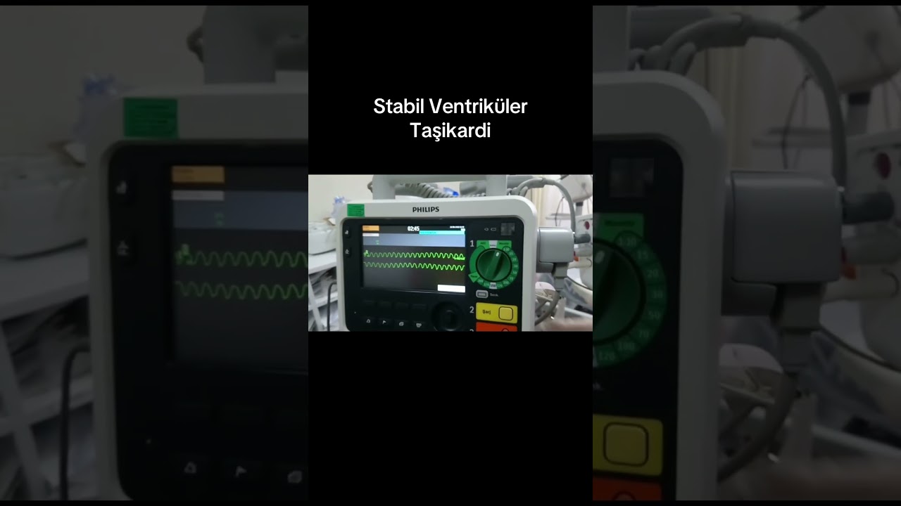 Stabil VT. Sizce tedavi nasıl olmalı?