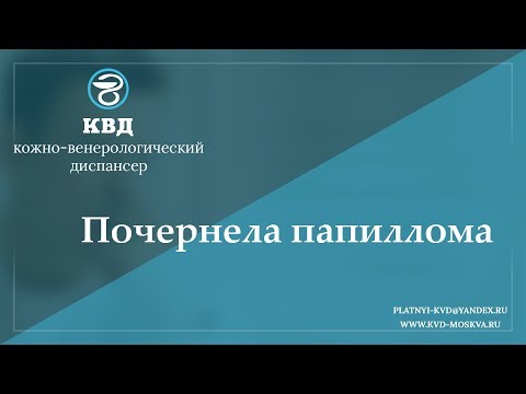 816  Почернела папиллома