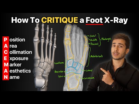 How To Critique a Foot X-Ray