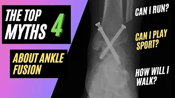 Is an ankle fusion a disability?