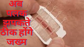 अब पलक झपकते ठीक होंगे जख्‍म Fastest Wound Healing Formula | Providine-AM Ointment & Vit C Tablets