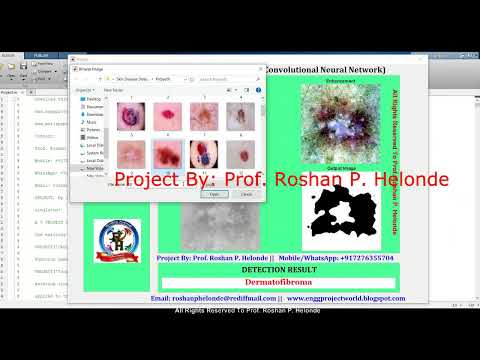 Skin Disease Detection Using Matlab | Skin Disease Detection Using Machine Learning | Deep Learning