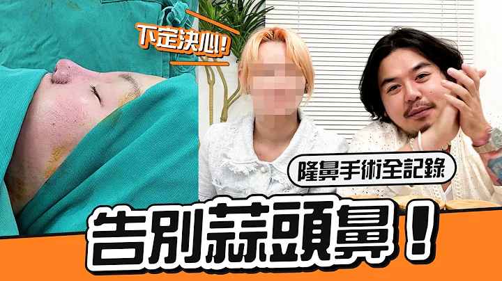 隆鼻手术超详细全记录！到底痛不痛啊？ - 天天要闻