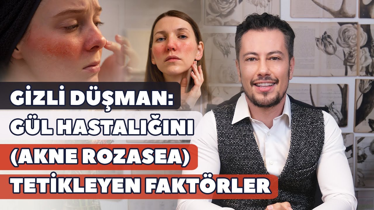 Gizli Düşman: Gül Hastalığını (Akne Rozasea) Tetikleyen Faktörler 🌹