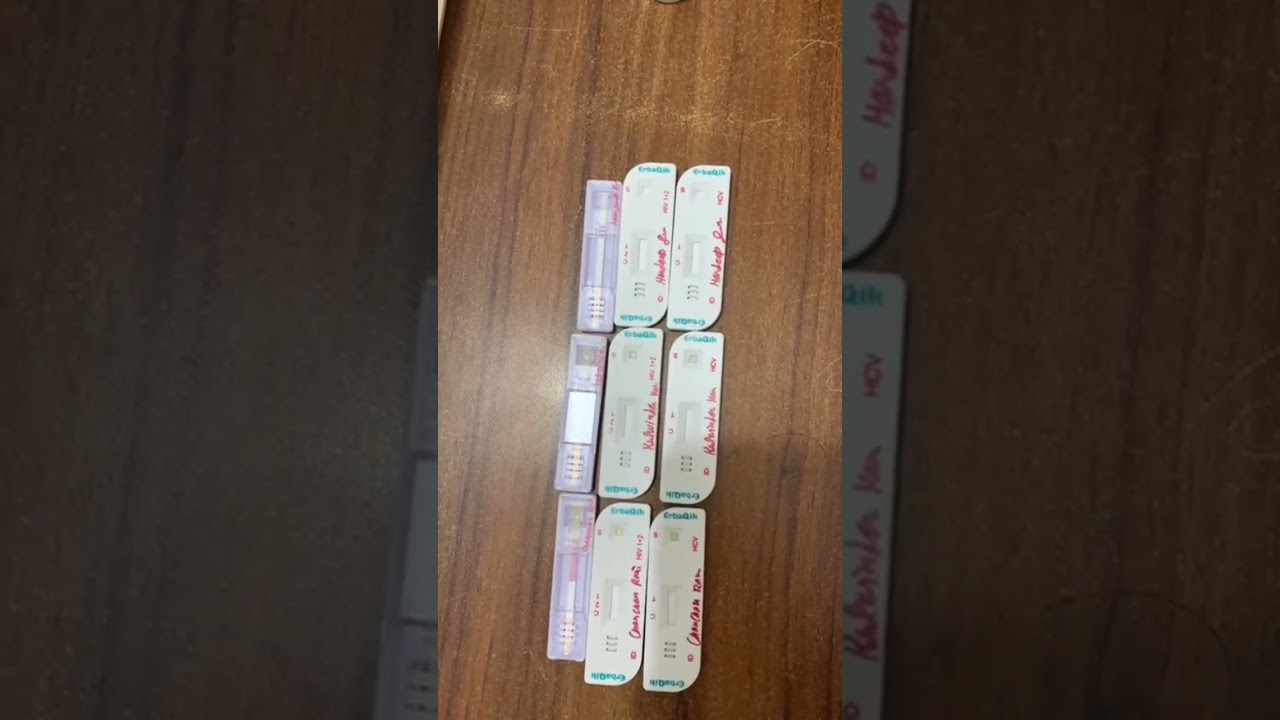 Hiv+Hepatitis B+Hepatitis c. card blood test 