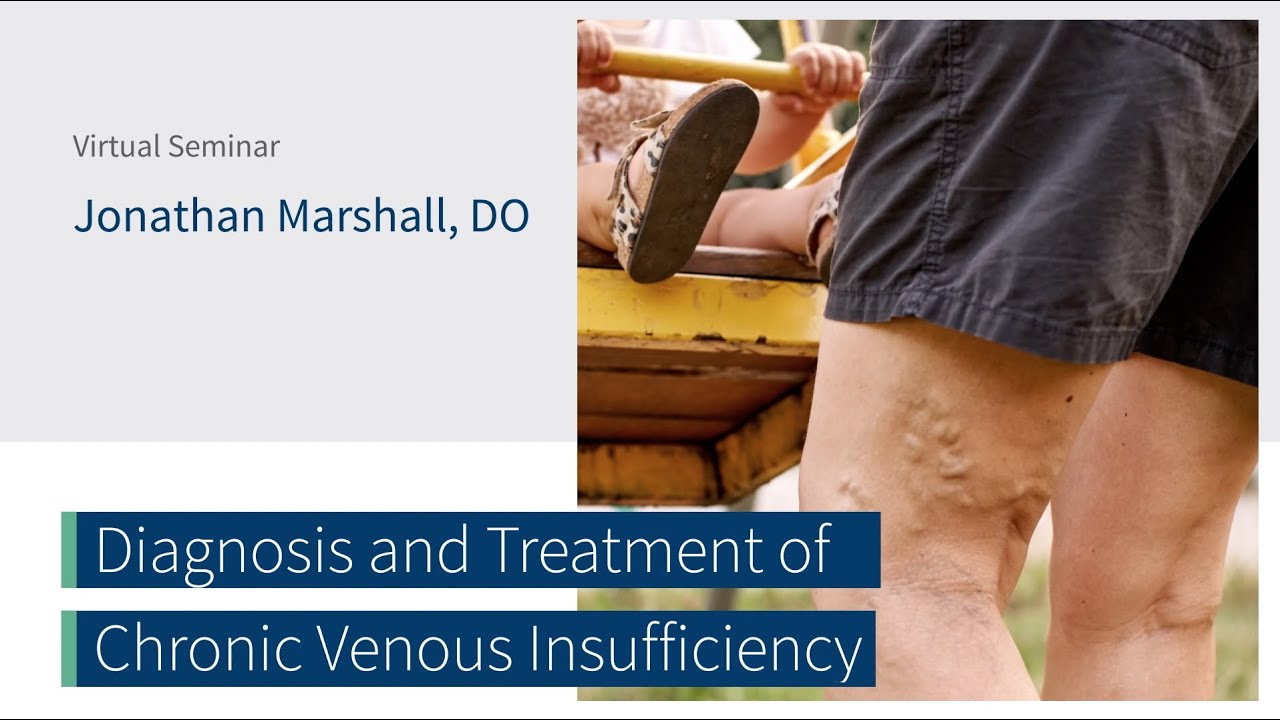 Diagnosis Treatment Of Chronic Venous Insufficiency W Dr Jonathan Diagnosis Treatment Of Chronic Venous Insufficiency W Dr Jonathan