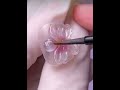 Toe Nail Fixer| Ingrown Toenail Cleaning & Care #ToenailFix #NailCare #FootCare #PedicureClean