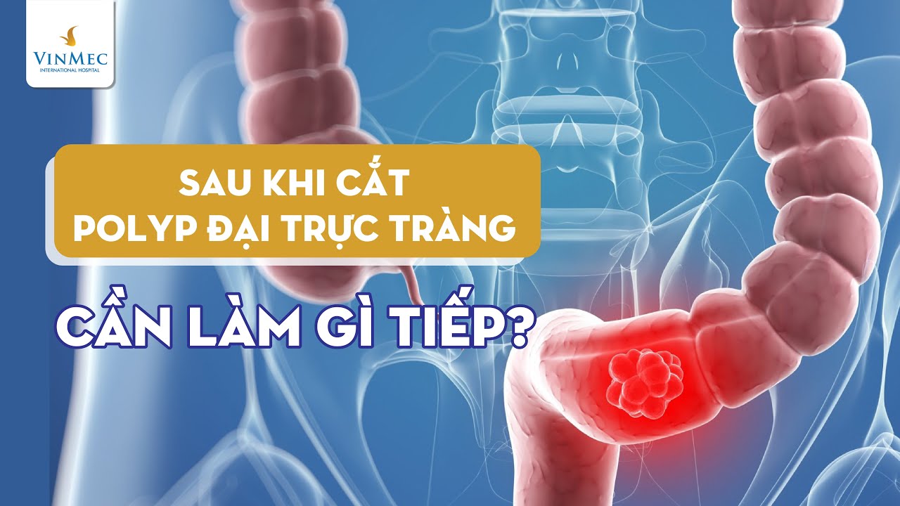 Sau cắt polyp đại trực tràng, cần làm gì tiếp?| PGS.TS Phạm Đức Huấn, BV Vinmec Times City