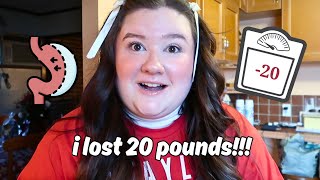 surgery update! (losing weight, what i've been eating, mental struggle & more)