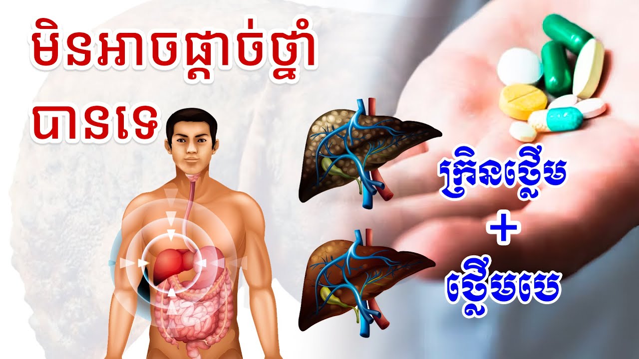 ក្រិនថ្លើមមានមេរោគបេ មិនអាចផ្តាច់ថ្នាំព្យាបាលមេរោគបានទេបើទោះមេរោគអស់ក៏ដោយ ។