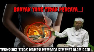 7 tahun sakit perut dan sesak di dada ...! Semua dokter spesialis sudah menyerah..! Ternyada ada jin