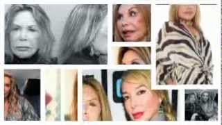 Elsa Patton Plastic Surgery Details