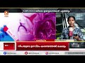 നിപയുടെ ഉറവിടം കണ്ടെത്താൻ കേന്ദ്ര സംഘം ഇന്ന് കോഴിക്കോട് എത്തും | Nipah