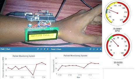 IoT based Smart Patient Monitoring System