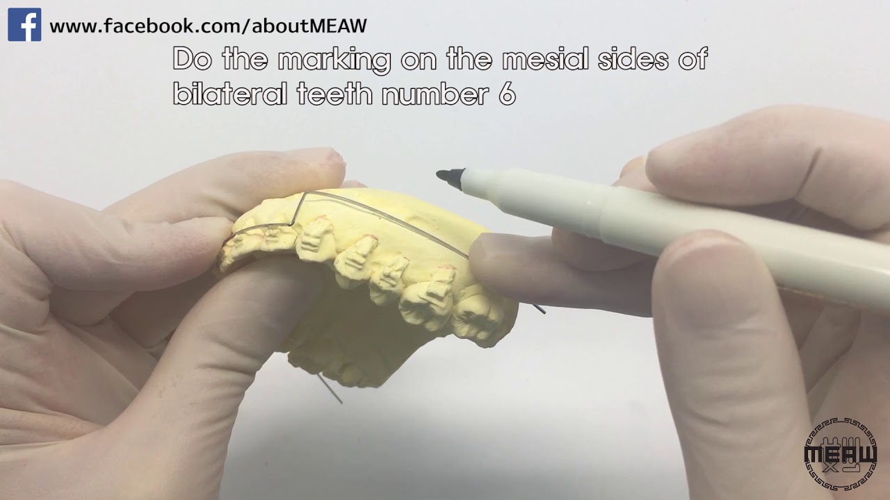 .016x.022ss Utility arch wire (Eng sub) YouTube