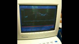 IR Spectroscopy no. 5  How to Run a Liquid Sample at Bryn Mawr College