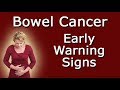 Early Warning Signs Of Bowel Cancer