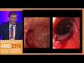 How should we manage and follow the low risk IBD patient with mild disease?