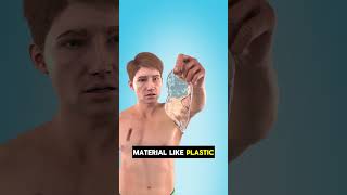 You Punctured Your Lungs, What Next?