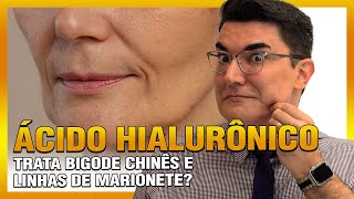 ÁCIDO HIALURÔNICO trata bigode chinês e linhas de marionete?