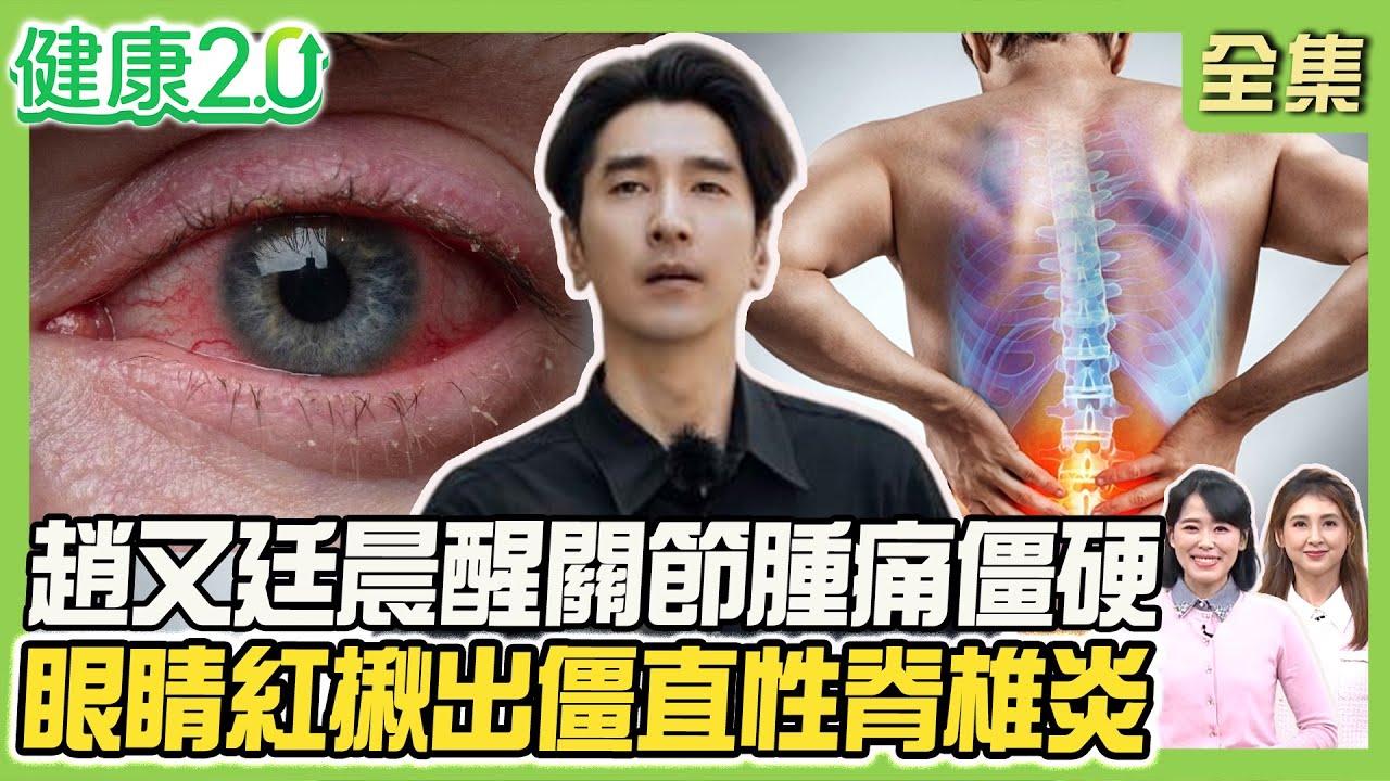 趙又廷罹類風濕關節炎晨醒關節腫痛僵硬！女星乾癬全身冒紅斑引35種共病！李東健紅眼揪僵直性脊椎炎！2招緩脊椎痛！健康2.0 20251213【完整版】#陳欣湄#韋汝#黃光永#柳朋馳#鄒瑋倫#胡逸惟#彥寬