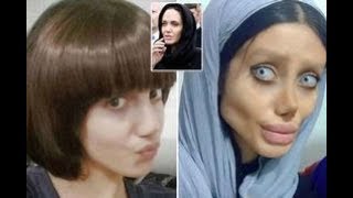 Iranian teen 'undergoes FIFTY surgeries' to look like Angelina Jolie Profile