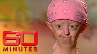 Extraordinary Hayley Okines on living with a rare ageing disease | 60 Minutes Australia