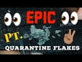 Thick  large quarantine flakes part 2  scratchers anonymous asmr dandruff flakes in quarantine