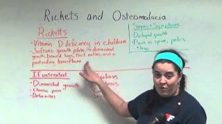 Ricketts And Osteomalacia