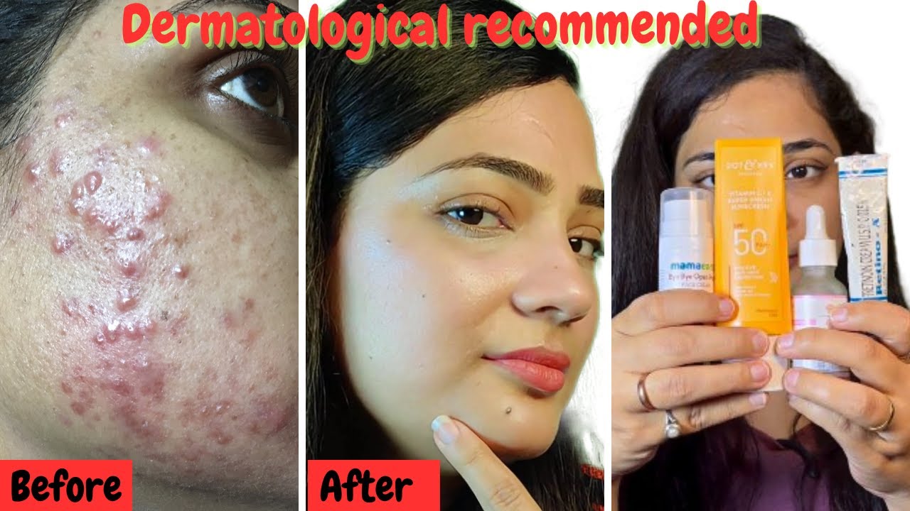 Dermatologists skincare products from Amazon Retino A 0.