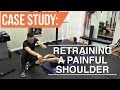 Case study: Retraining a painful, aching shoulder