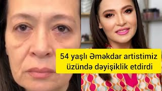 54 Yaşlı Əməkdar Artistimiz Üzündə Dəyişiklik Etdirdi
