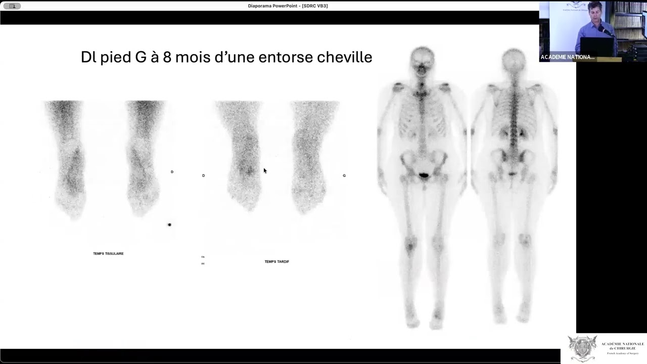 05 L'apport de l'imagerie médicale