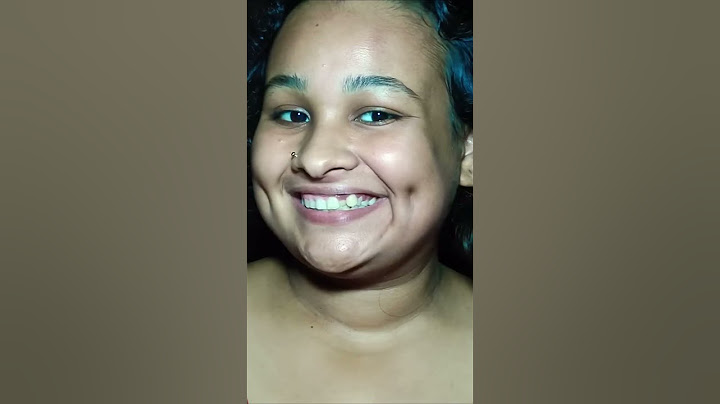 trying fake dimple hack 😱 get dimple in 2 minutes😳 #shorts  #trend #dimplehack