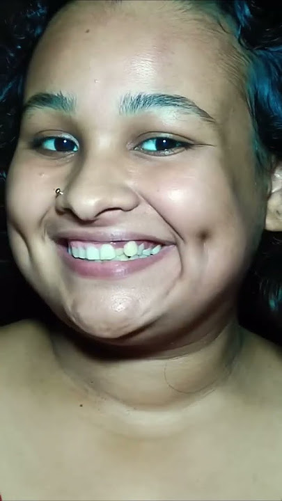 trying fake dimple hack 😱 get dimple in 2 minutes😳 #shorts  #trend #dimplehack