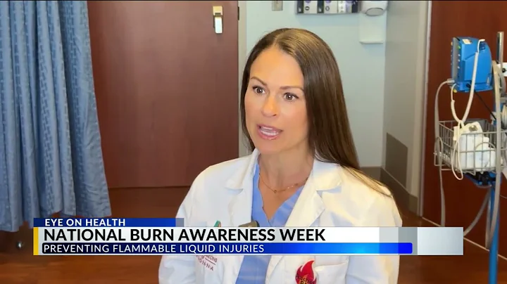 National Burn Awareness Week